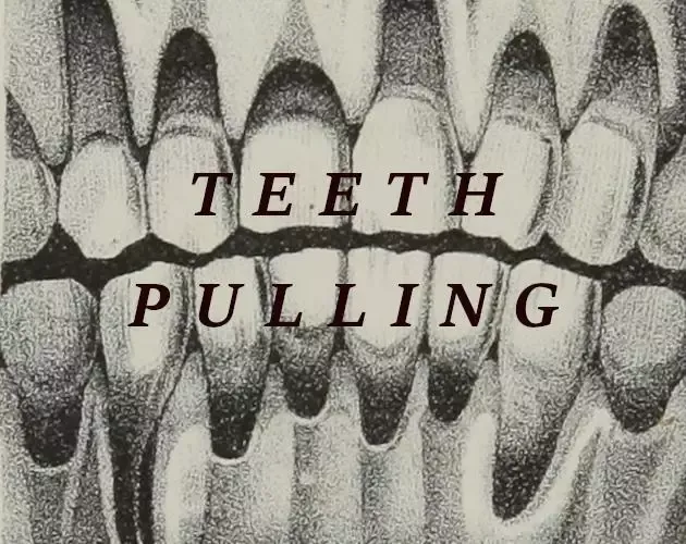 -Teeth Pulling-游戏截图-好玩游戏库